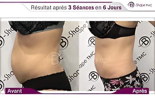 002   AV AP B Shape TMC 2022  1