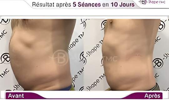 009   AV AP B Shape TMC 2022  1