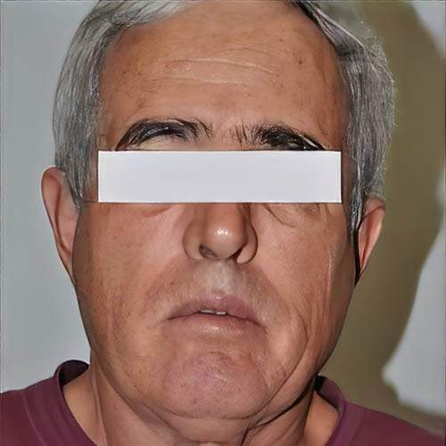 Soins de rajeunissement Saint-Jean-sur-Richelieu