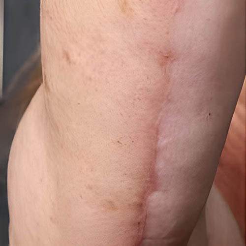 Soin de la peau Saint-Jean-sur-Richelieu