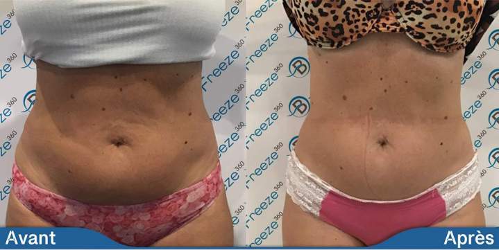 Weight Loss Solution Saint-Jean-sur-Richelieu