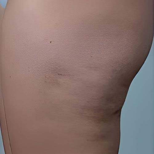 Soin de la peau Saint-Jean-sur-Richelieu