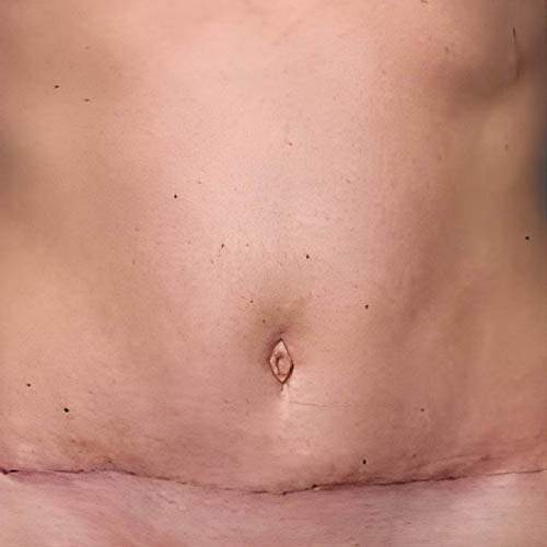 Solution de perte de poids Saint-Jean-sur-Richelieu