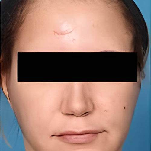 Traitement de la peau Saint-Jean-sur-Richelieu