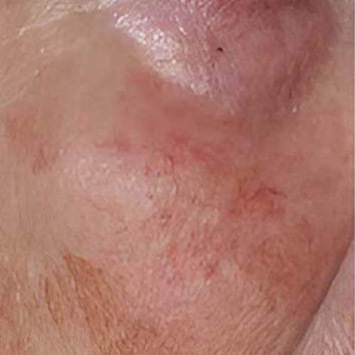 Soin de la peau Saint-Jean-sur-Richelieu