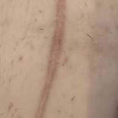 Soin de la peau Saint-Jean-sur-Richelieu