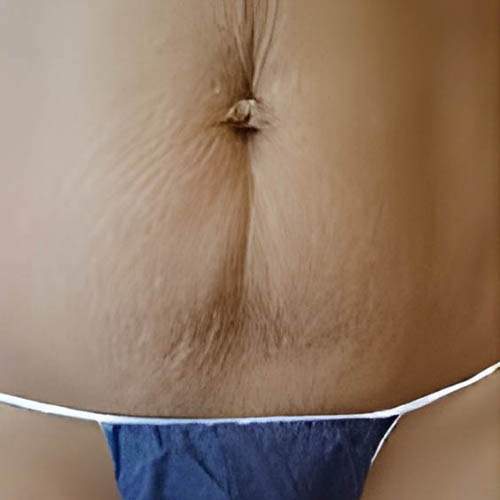 Traitement perte de poids Saint-Jean-sur-Richelieu