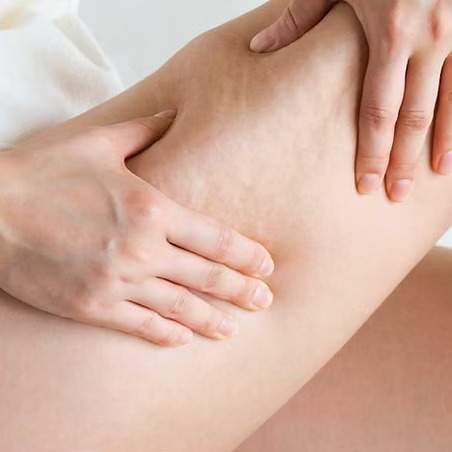 Traitement de la peau Saint-Jean-sur-Richelieu