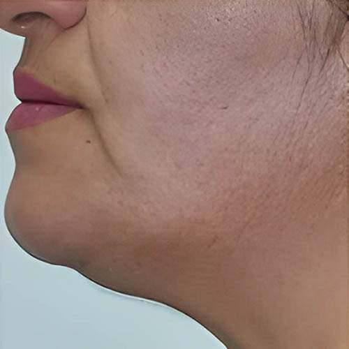 Traitement de la peau Saint-Jean-sur-Richelieu