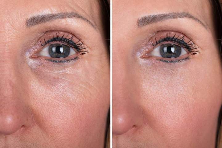 Rejuvenation Treatment Saint-Jean-sur-Richelieu