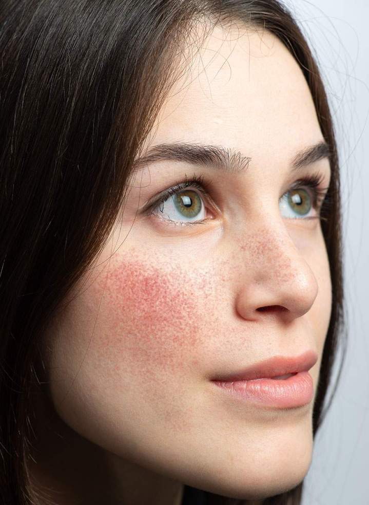 Soin de la peau Saint-Jean-sur-Richelieu