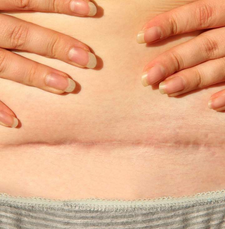 Soin de la peau Saint-Jean-sur-Richelieu