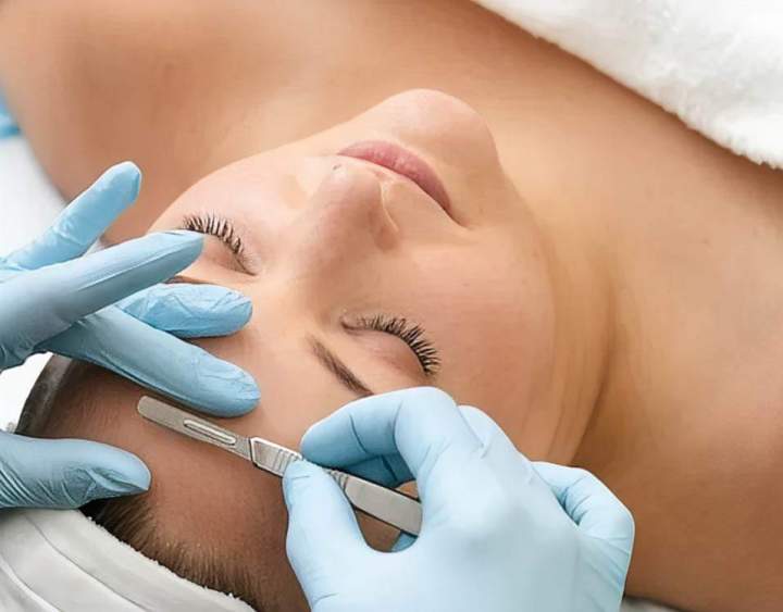 Traitement de la peau Saint-Jean-sur-Richelieu