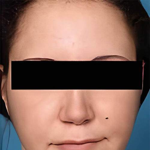 Traitement de la peau Saint-Jean-sur-Richelieu