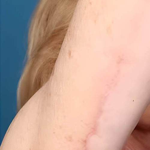 Soin de la peau Saint-Jean-sur-Richelieu