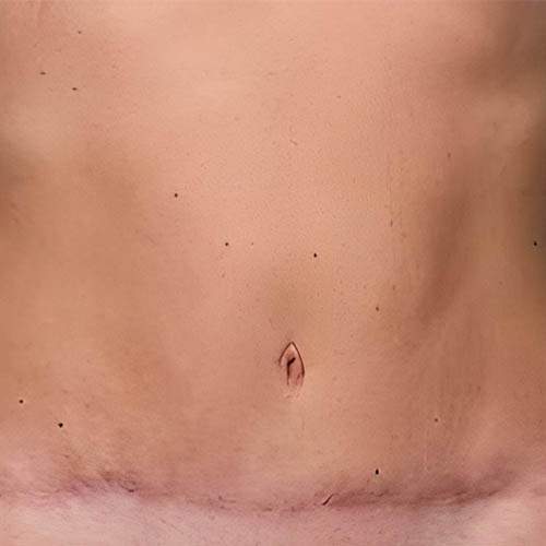 Solution de perte de poids Saint-Jean-sur-Richelieu