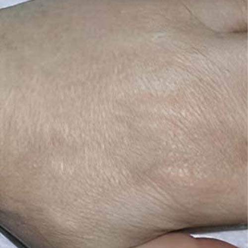 Soin de la peau Saint-Jean-sur-Richelieu