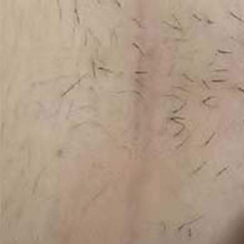 Soin de la peau Saint-Jean-sur-Richelieu