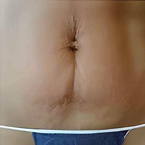 Traitement perte de poids Saint-Jean-sur-Richelieu