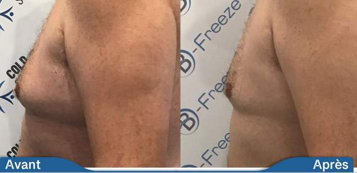 Weight Loss Treatment Saint-Jean-sur-Richelieu  