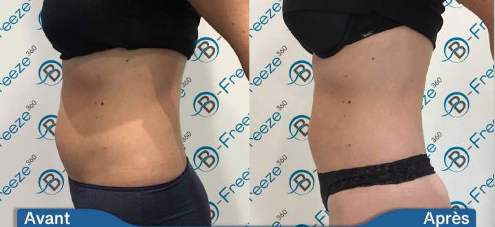 Weight Loss Solution Saint-Jean-sur-Richelieu