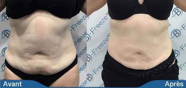 Weight Loss Solution Saint-Jean-sur-Richelieu