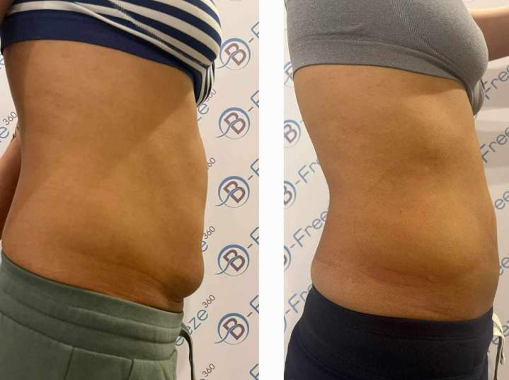 Solution de perte de poids Saint-Jean-sur-Richelieu