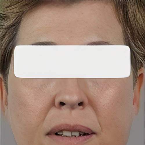 Soins de rajeunissement Saint-Jean-sur-Richelieu