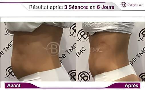 68bc17 7adc4bad71714ff6a128ac6fa13638be~mv2