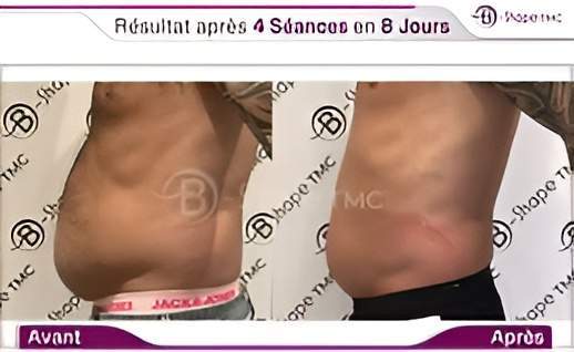 Skin Care Saint-Jean-sur-Richelieu