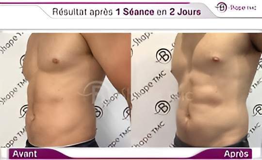 68bc17 d7dd7e2dfc5249bfa3b563ebb2dce67c~mv2